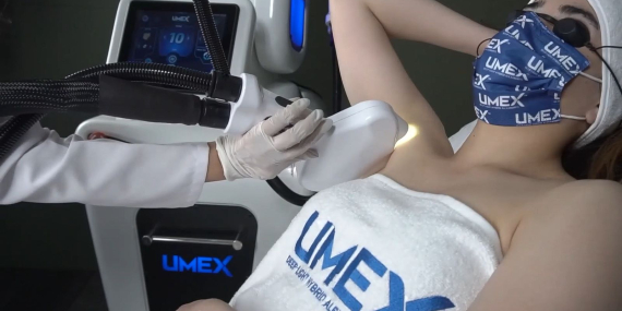 Umex Lazer Epilasyon Aleti