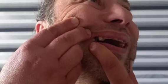 Onur Akay’ı darp eden Kadir Doğulu hayranı 2 kadın yakalandı!