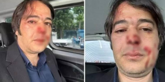 Üsküdar Salacak sahilinde kaçak kafeyi yıkmak isteyen İBB çalışanları darp edildi: Kent zorbaları!