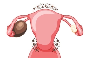 10-SORUDA-ENDOMETRIOZIS-DOSYASI-Dunyada-ilk-kez-bilinen-her.jpg