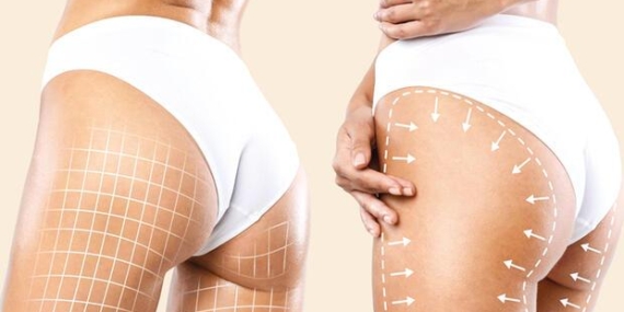 Estetik Plastik Cerrahi Uzmanı Op. Dr. Bülent Cihantimur: Genital güzelleştirme ve yağ transferi