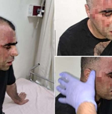 Gazeteci-Sinan-Aygul-Tatvan-Belediye-Baskani039nin-korumalarinin-saldirisina-ugradim.jpg