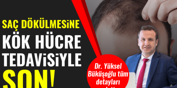 Saç Dökülmesine Kök Hücre Tedavisi ile Son!
