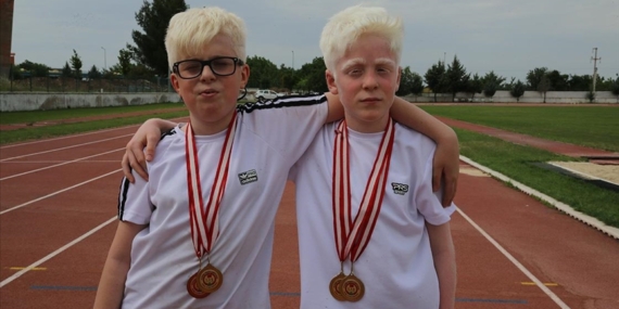 Türkiye şampiyonu albino çocuklar atletizmde uluslararası başarılara odaklandı