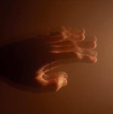Arastirma-Parkinson-hastaligi-akilli-saatler-sayesinde-7-yil-onceden-teshis.jpg