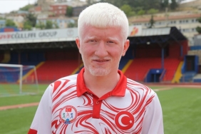 Azmiyle-engelini-asan-albino-milli-atlet-yeni-hedeflere-odaklandi.jpg