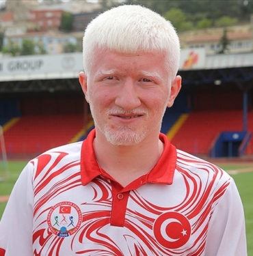 Azmiyle-engelini-asan-albino-milli-atlet-yeni-hedeflere-odaklandi.jpg