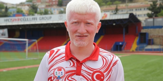 Azmiyle engelini aşan albino milli atlet, yeni hedeflere odaklandı