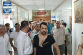 AKP039li-belediye-baskanindan-IYI-Partili-Meclis-uyesine-yumruklu-saldiri.jpg